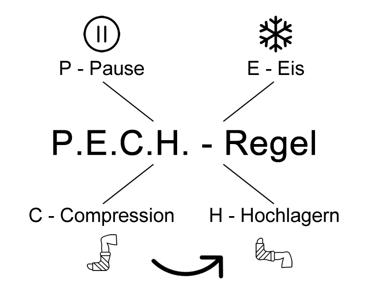 Grafische Darstellung der PECH-Regel